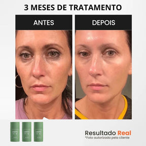 Mascara Verde Natural | Tratamento Definitivo para Rugas, Manchas e Marcas no Rosto